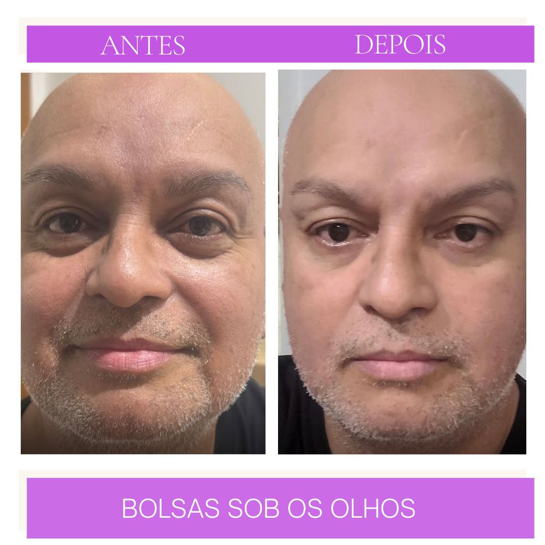 Produto 5
